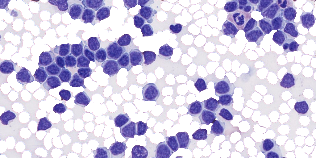 Patch-level RBCs Segmentation